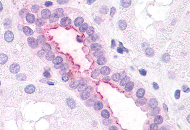 CXCR2 Antibody in Immunohistochemistry (Paraffin) (IHC (P))