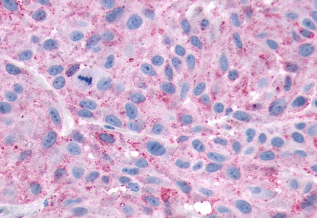 CXCR3 Antibody in Immunohistochemistry (Paraffin) (IHC (P))