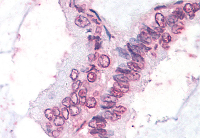 NR0B1 Antibody in Immunohistochemistry (Paraffin) (IHC (P))