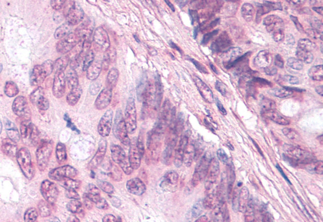 NR0B1 Antibody in Immunohistochemistry (Paraffin) (IHC (P))