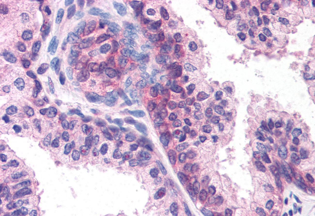 DHRS7 Antibody in Immunohistochemistry (Paraffin) (IHC (P))