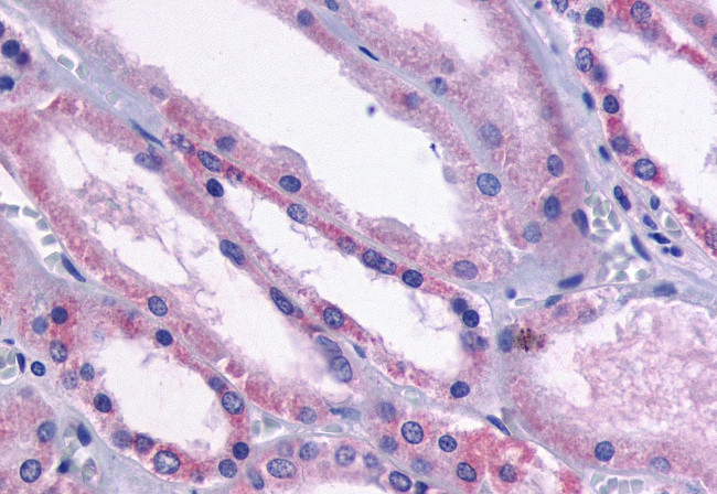 DRD1 Antibody in Immunohistochemistry (Paraffin) (IHC (P))