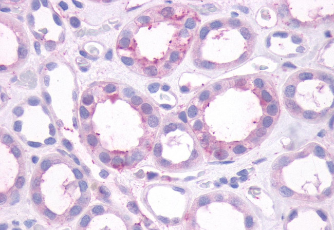 DRD1 Antibody in Immunohistochemistry (Paraffin) (IHC (P))