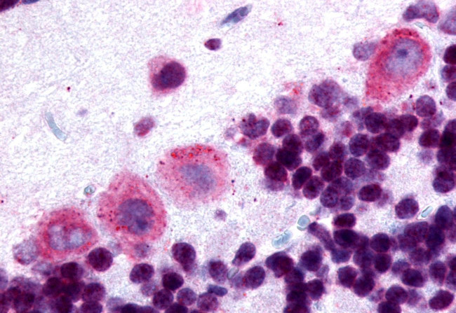 DRD5 Antibody in Immunohistochemistry (Paraffin) (IHC (P))