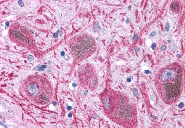 DUSP23 Antibody in Immunohistochemistry (Paraffin) (IHC (P))