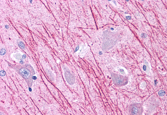 DUSP23 Antibody in Immunohistochemistry (Paraffin) (IHC (P))