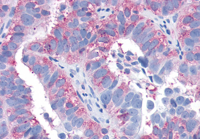 EDG3 Antibody in Immunohistochemistry (Paraffin) (IHC (P))