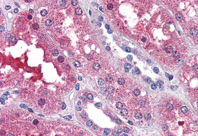 EDG3 Antibody in Immunohistochemistry (Paraffin) (IHC (P))