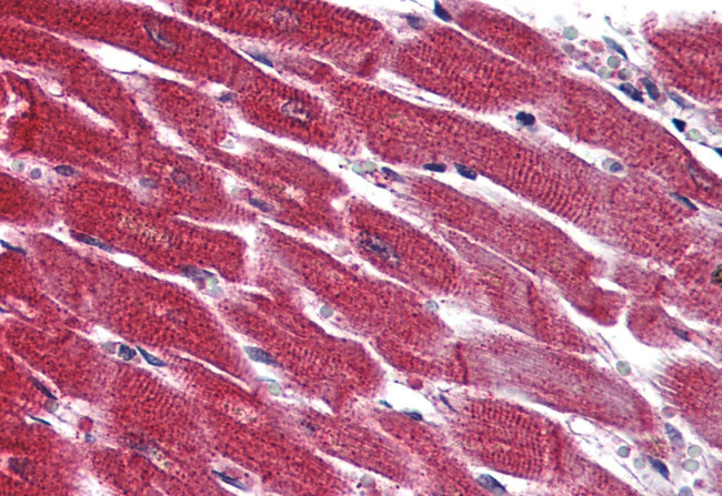 EDG3 Antibody in Immunohistochemistry (Paraffin) (IHC (P))