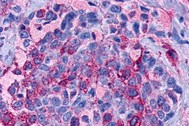 LPAR3 Antibody in Immunohistochemistry (Paraffin) (IHC (P))