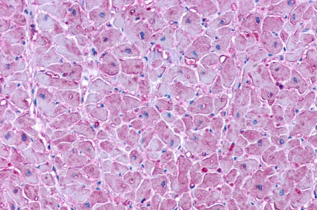 LPAR3 Antibody in Immunohistochemistry (Paraffin) (IHC (P))