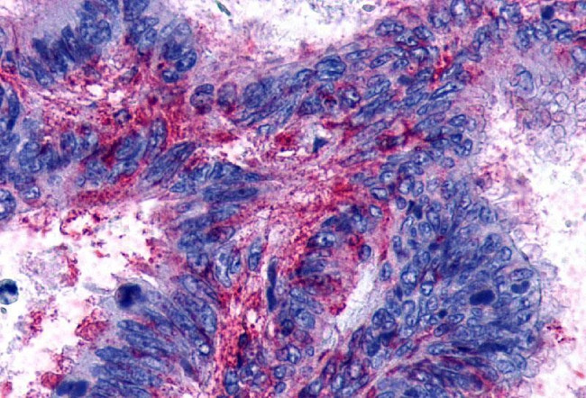 LPAR3 Antibody in Immunohistochemistry (Paraffin) (IHC (P))