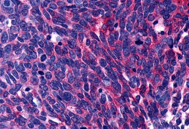 LPAR3 Antibody in Immunohistochemistry (Paraffin) (IHC (P))