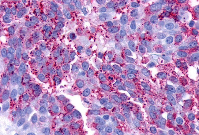 LPAR3 Antibody in Immunohistochemistry (Paraffin) (IHC (P))