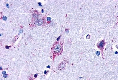 LPAR3 Antibody in Immunohistochemistry (Paraffin) (IHC (P))