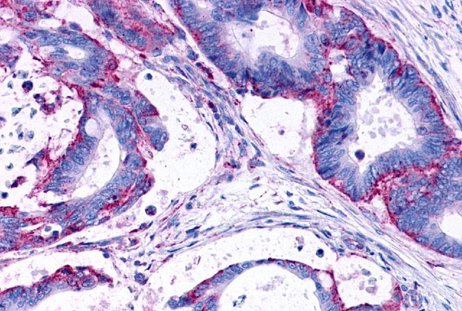 LPAR3 Antibody in Immunohistochemistry (Paraffin) (IHC (P))