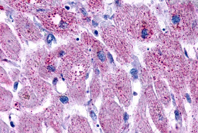 LPAR3 Antibody in Immunohistochemistry (Paraffin) (IHC (P))