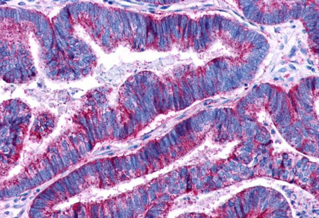 LPAR3 Antibody in Immunohistochemistry (Paraffin) (IHC (P))