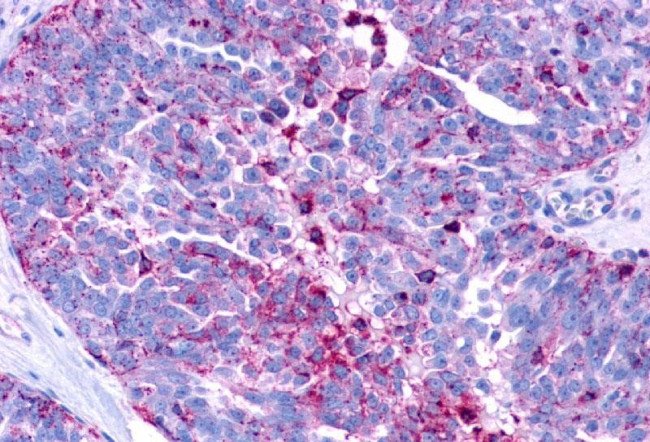 LPAR3 Antibody in Immunohistochemistry (Paraffin) (IHC (P))