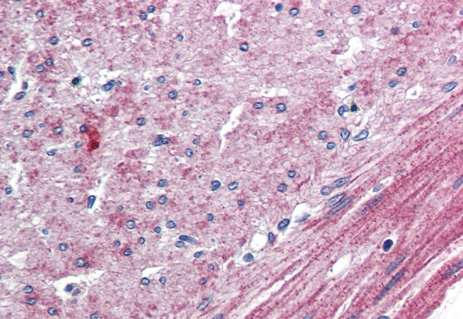 ELTD1 Antibody in Immunohistochemistry (Paraffin) (IHC (P))