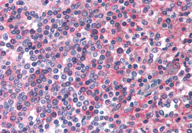 EMR2 Antibody in Immunohistochemistry (Paraffin) (IHC (P))