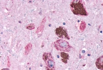 EMR2 Antibody in Immunohistochemistry (Paraffin) (IHC (P))