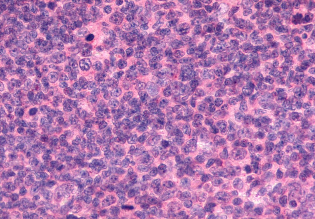 EMR2 Antibody in Immunohistochemistry (Paraffin) (IHC (P))