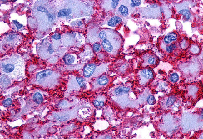 PTGER2 Antibody in Immunohistochemistry (Paraffin) (IHC (P))