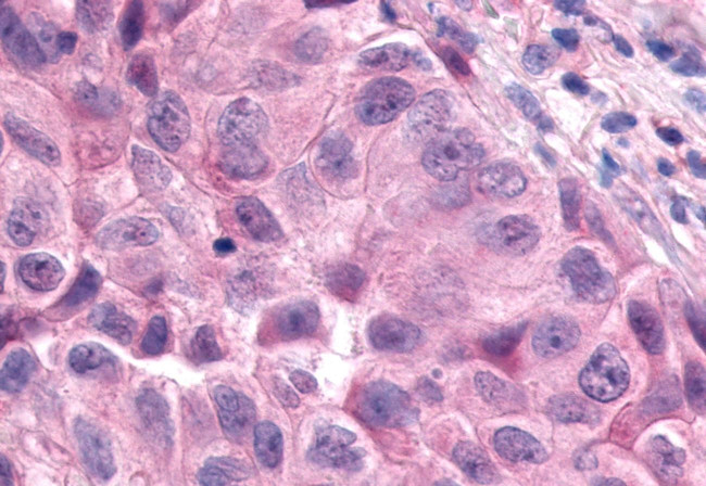 ESRRA Antibody in Immunohistochemistry (Paraffin) (IHC (P))