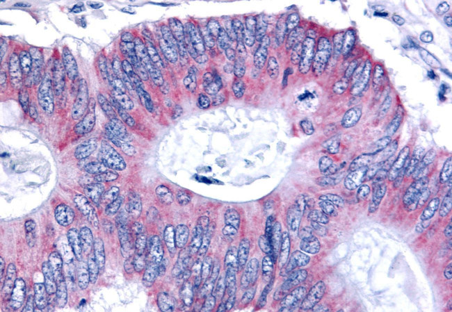 ESRRB Antibody in Immunohistochemistry (Paraffin) (IHC (P))