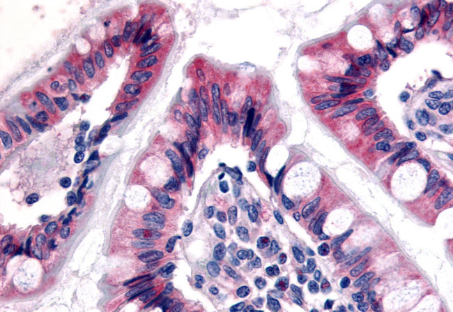 ESRRG Antibody in Immunohistochemistry (Paraffin) (IHC (P))