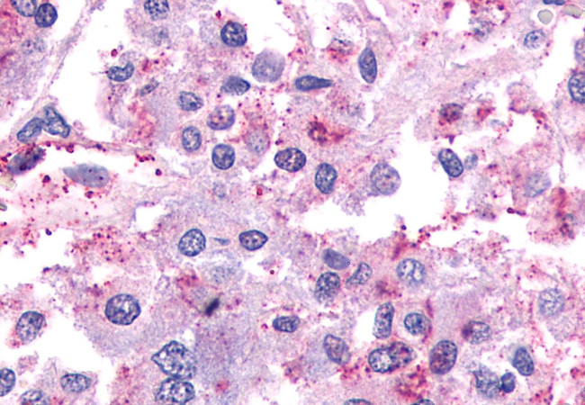 PAR2 Antibody in Immunohistochemistry (Paraffin) (IHC (P))