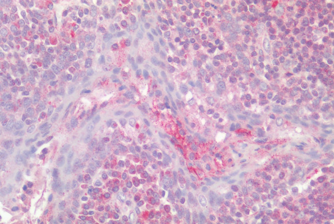 PAR3 Antibody in Immunohistochemistry (Paraffin) (IHC (P))