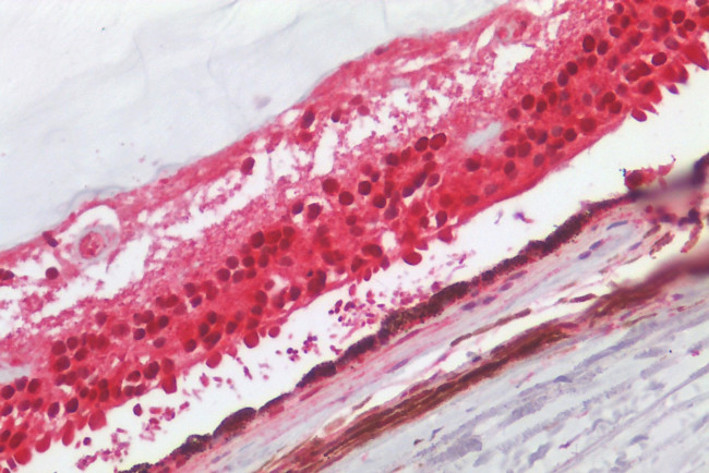 PAR3 Antibody in Immunohistochemistry (Paraffin) (IHC (P))