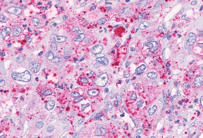 GPR41 Antibody in Immunohistochemistry (Paraffin) (IHC (P))