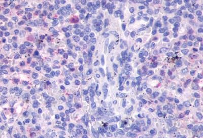 FPR3 Antibody in Immunohistochemistry (Paraffin) (IHC (P))