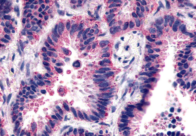 Frizzled-2 Antibody in Immunohistochemistry (Paraffin) (IHC (P))