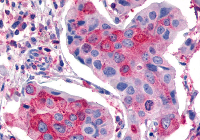 Frizzled-2 Antibody in Immunohistochemistry (Paraffin) (IHC (P))