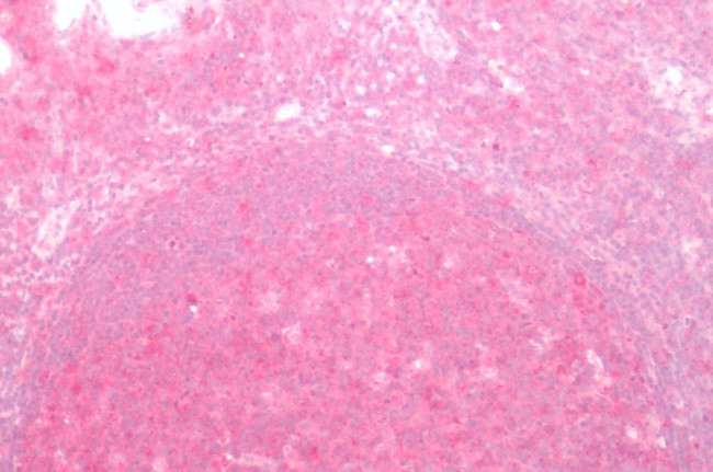 Frizzled-2 Antibody in Immunohistochemistry (Paraffin) (IHC (P))