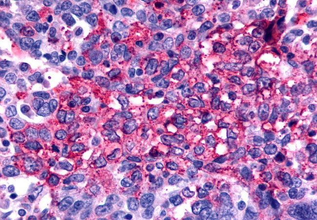 Frizzled-2 Antibody in Immunohistochemistry (Paraffin) (IHC (P))