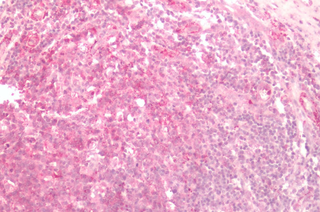 Frizzled-2 Antibody in Immunohistochemistry (Paraffin) (IHC (P))