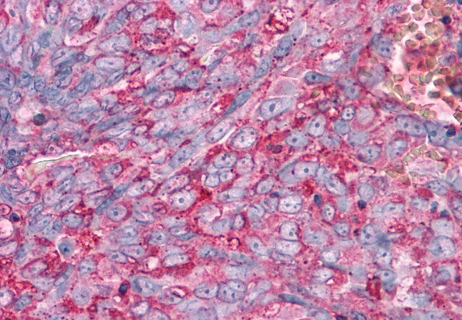 FZD1 Antibody in Immunohistochemistry (Paraffin) (IHC (P))