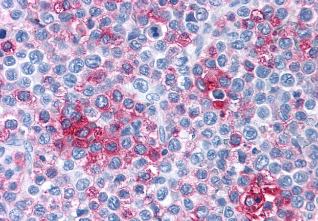 FZD1 Antibody in Immunohistochemistry (Paraffin) (IHC (P))