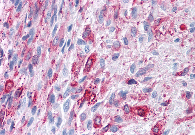 FZD1 Antibody in Immunohistochemistry (Paraffin) (IHC (P))