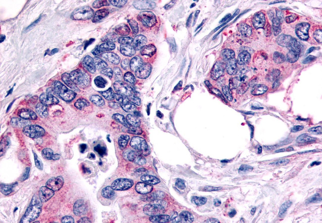 FZD10 Antibody in Immunohistochemistry (Paraffin) (IHC (P))