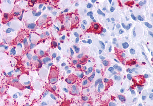 FZD4 Antibody in Immunohistochemistry (Paraffin) (IHC (P))