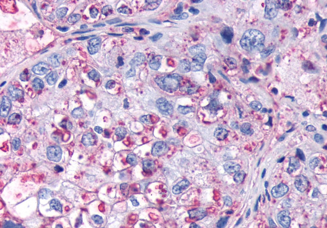 FZD4 Antibody in Immunohistochemistry (Paraffin) (IHC (P))