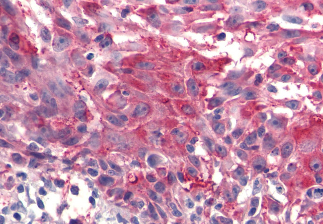 FZD4 Antibody in Immunohistochemistry (Paraffin) (IHC (P))