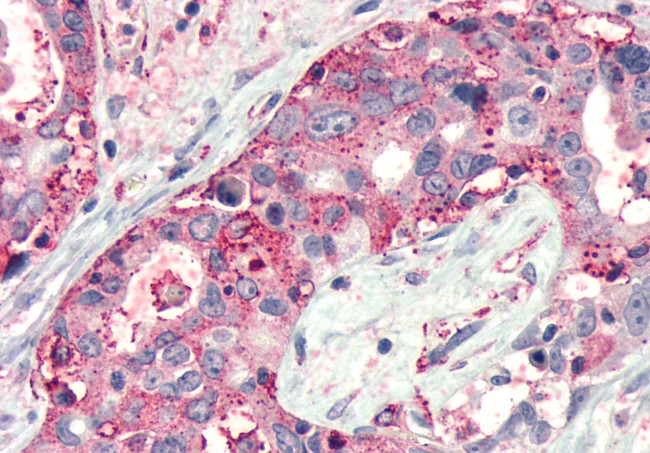 FZD4 Antibody in Immunohistochemistry (Paraffin) (IHC (P))