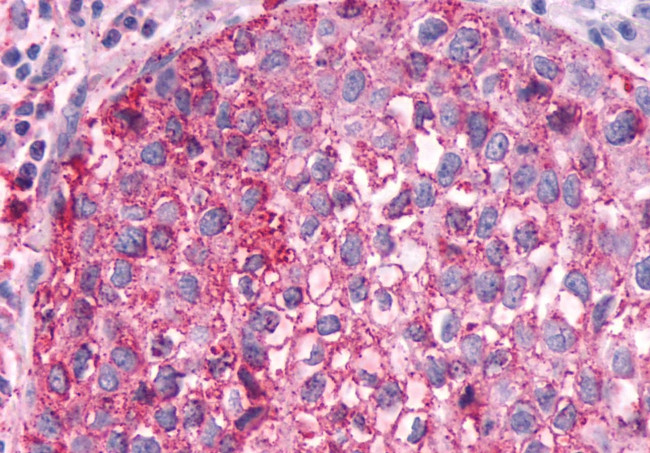 FZD4 Antibody in Immunohistochemistry (Paraffin) (IHC (P))